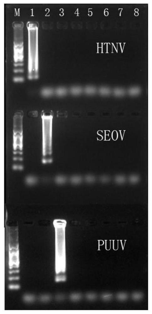 用于檢測(cè)漢坦病毒的檢測(cè)引物、檢測(cè)試劑盒及檢測(cè)方法